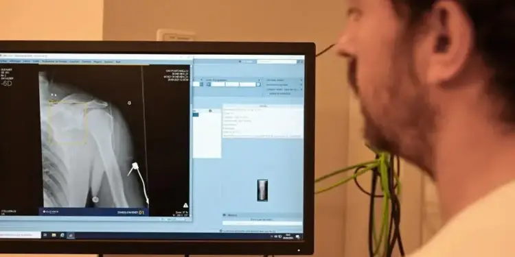 Un profesional observa una radiografía de hombro en la pantalla de un ordenador en una oficina.
